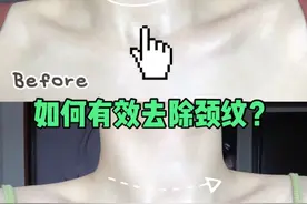女人都敌不过显老5岁的颈纹！脖子上的“沟沟壑壑”该怎么办？图片