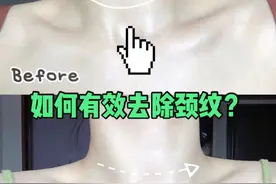 女人都敌不过显老5岁的颈纹！脖子上的“沟沟壑壑”该怎么办？图片
