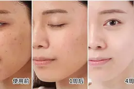 紧急提醒！长期喝胶原蛋白的人居然变成了这样...没看的赶紧看看吧图片