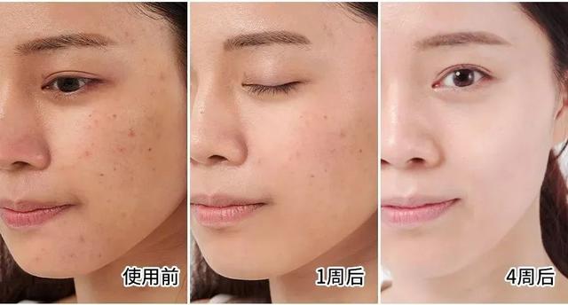 鱼胶原蛋白肽粉的可以长期使用吗 鱼胶原蛋白肽粉固体饮料长期喝有没