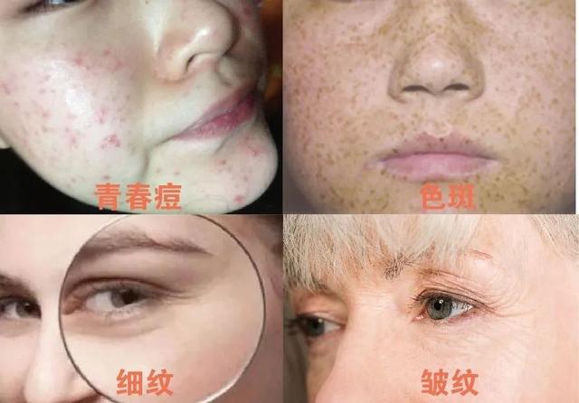 经常喝胶原蛋白有什么副作用 2026年经常喝胶原蛋白有什么副作用和危害