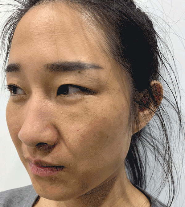 鱼胶原蛋白肽粉的可以长期使用吗 鱼胶原蛋白肽粉固体饮料长期喝有没