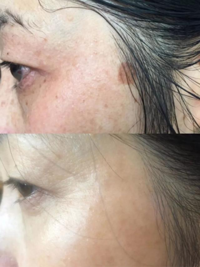 天天喝胶原蛋白对身体有害吗 2026年天天喝胶原蛋白的好处