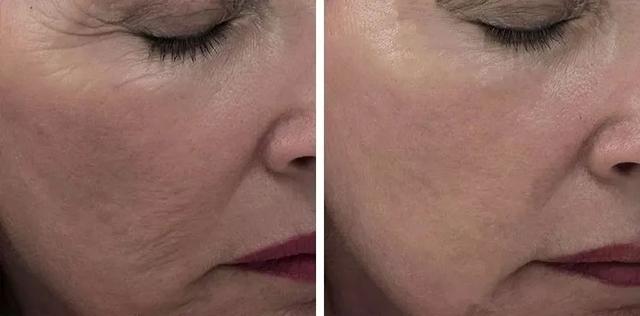 天天喝胶原蛋白对身体有害吗 2026年天天喝胶原蛋白的好处