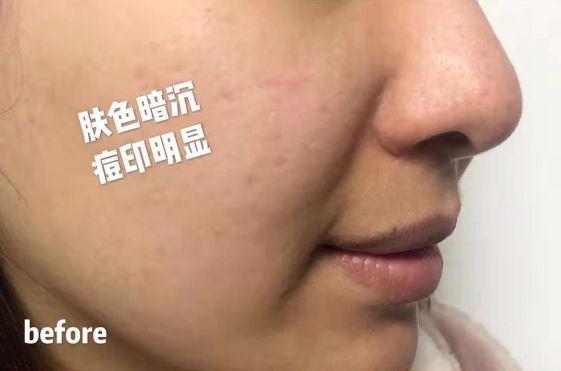 鱼胶原蛋白肽粉的可以长期使用吗 鱼胶原蛋白肽粉固体饮料长期喝有没