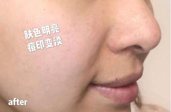 鱼胶原蛋白肽粉的可以长期使用吗 鱼胶原蛋白肽粉固体饮料长期喝有没