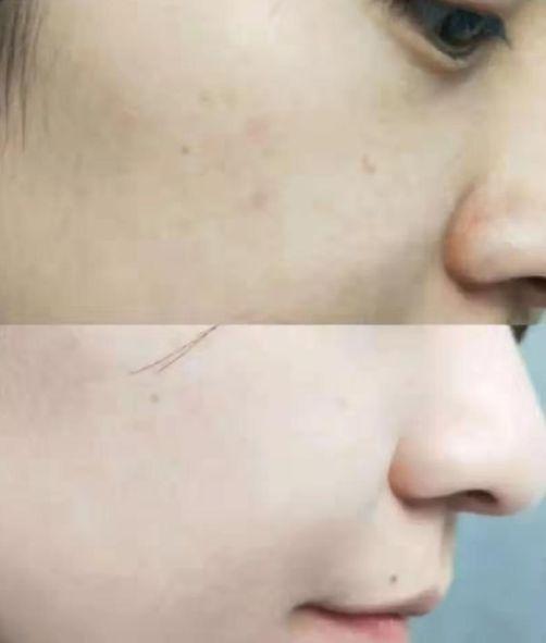 女性长期喝胶原蛋白的坏处 2026年女人吃什么补胶原蛋白皮肤好＂,＂n