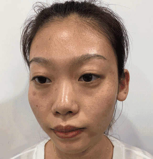 鱼胶原蛋白肽粉的可以长期使用吗 鱼胶原蛋白肽粉固体饮料长期喝有没