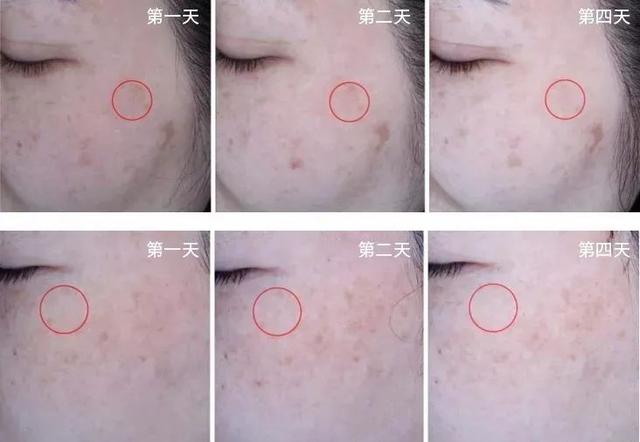 鱼胶原蛋白肽粉的可以长期使用吗 鱼胶原蛋白肽粉固体饮料长期喝有没