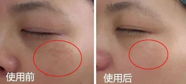 鱼胶原蛋白肽粉的可以长期使用吗 鱼胶原蛋白肽粉固体饮料长期喝有没