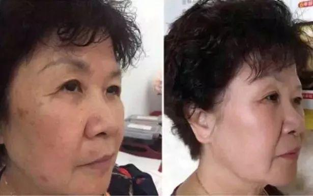 鱼胶原蛋白肽粉的可以长期使用吗 鱼胶原蛋白肽粉固体饮料长期喝有没