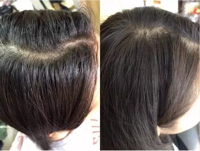 鱼胶原蛋白肽粉的可以长期使用吗 鱼胶原蛋白肽粉固体饮料长期喝有没