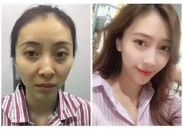 鱼胶原蛋白肽粉的可以长期使用吗 鱼胶原蛋白肽粉固体饮料长期喝有没