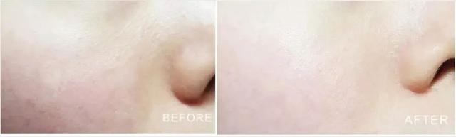 长期喝胶原蛋白危害 2026年长期喝胶原蛋白肽危害