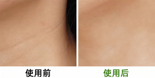 鱼胶原蛋白肽粉的可以长期使用吗 鱼胶原蛋白肽粉固体饮料长期喝有没