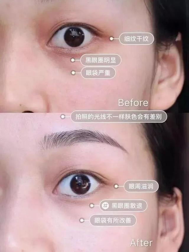 长期喝胶原蛋白危害 2026年长期喝胶原蛋白肽危害