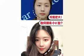 注射后感觉又酸又胀的？我是不是打了假的瘦脸针？图片