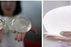 假体丰胸的手感怎么样？能摸出来是假体隆胸吗？图片
