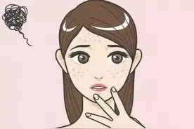 那些影响颜值的“面部色斑”是怎么回事？图片