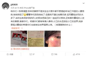 助理晒王雨馨黄景瑜结婚证和女方受伤照 控黄景瑜劈腿家暴图片