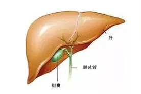 胆囊癌那些事儿图片