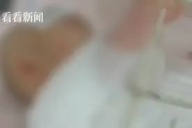 1岁女童掉入70℃热水锅烧伤大出血 妈妈自责：要血，从我身上抽图片