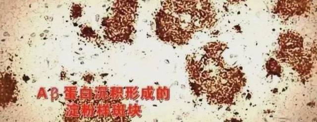 这3个年纪的人更容易“老得快”！原因与蛋白质有关……