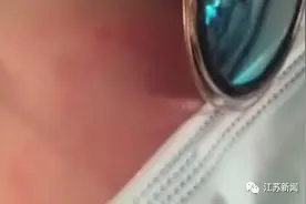年轻姑娘脸上居然长了脚气！平时爱做这事的人要当心了……图片