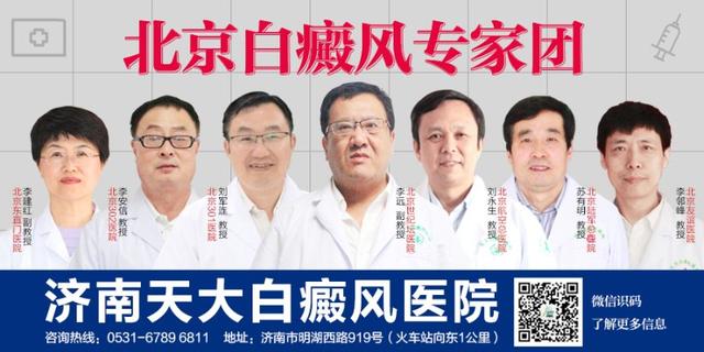 孩子身上出现白斑是不是白癜风？婴幼儿白癜风有什么症状？