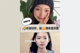 明明只需做个双眼皮，为何非要坚持开内眼角？图片