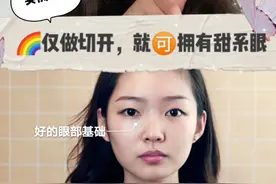 明明只需做个双眼皮，为何非要坚持开内眼角？图片