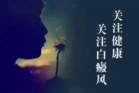 白癜风专家：我和三包喜糖的故事图片