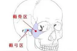 韩啸医生解析什么是降颧弓图片