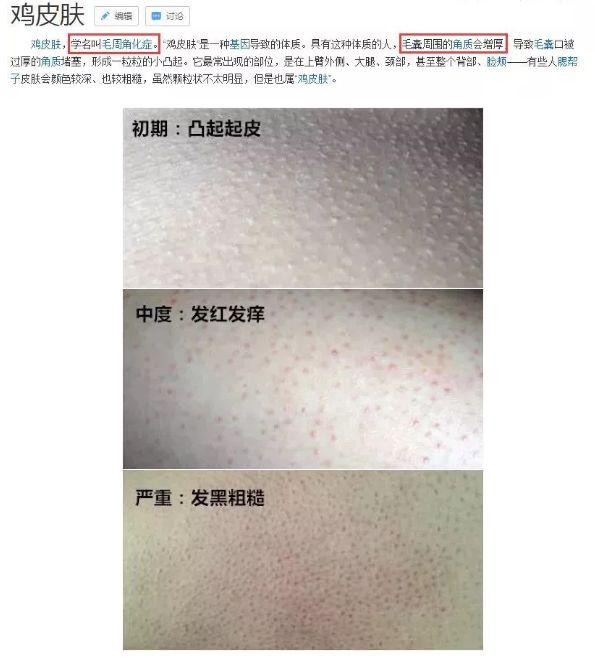 最近皮肤像鸡皮疙瘩