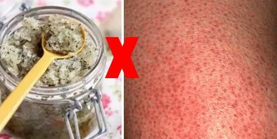 局部皮肤变粗糙摸起来像鸡皮疙瘩