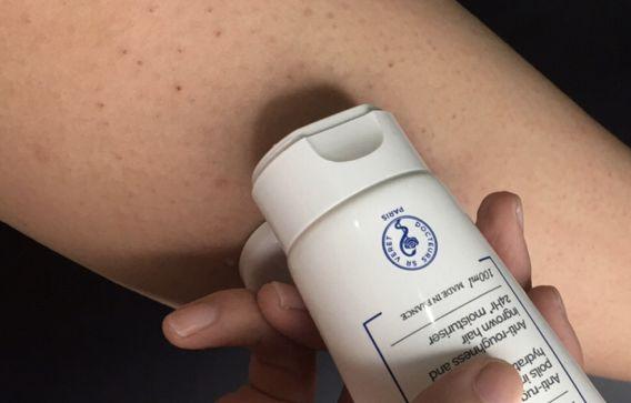 局部皮肤变粗糙摸起来像鸡皮疙瘩