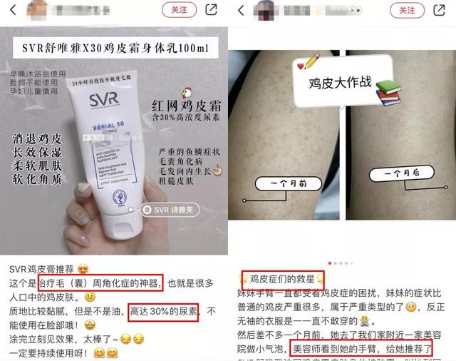 局部皮肤变粗糙摸起来像鸡皮疙瘩