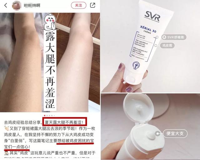 局部皮肤变粗糙摸起来像鸡皮疙瘩