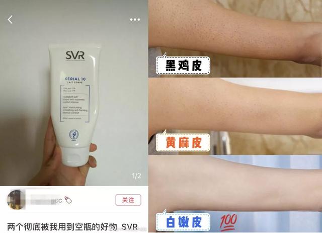 局部皮肤变粗糙摸起来像鸡皮疙瘩