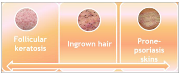 最近皮肤像鸡皮疙瘩