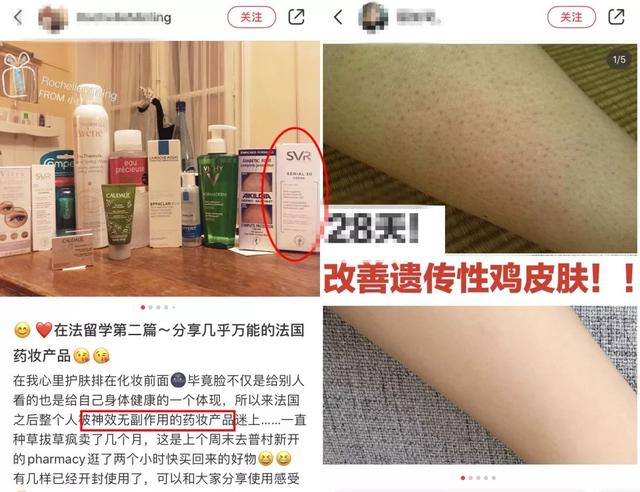 最近皮肤像鸡皮疙瘩