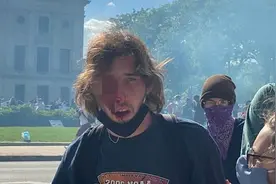 白人男子被催泪弹打瞎一只眼：这点痛与非裔美国人的痛比不算什么图片