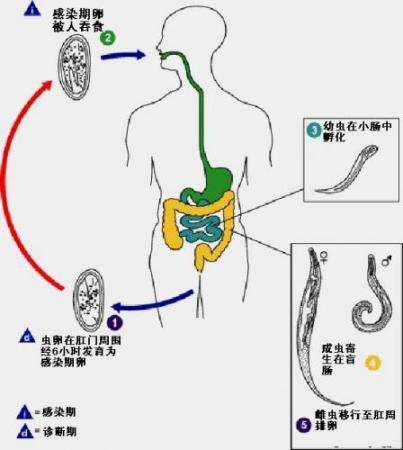 儿童肛周瘙痒，警惕蛲虫感染