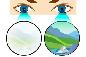 儿童弱视要做到这六点！听听中西医结合眼病专家怎么说图片