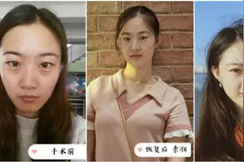 做完医美真的能换脸？慢着，先听听过来人怎么说图片