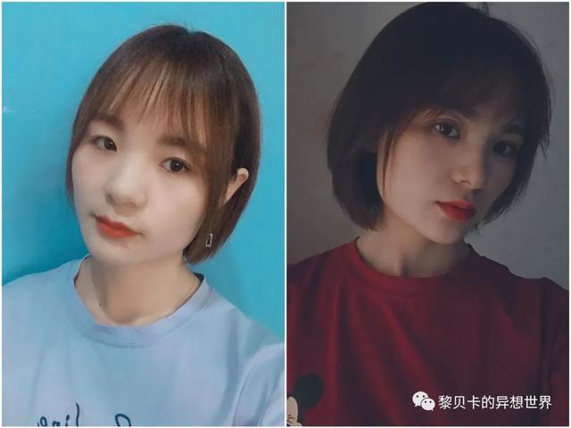 脂溢性角化激光大概费用