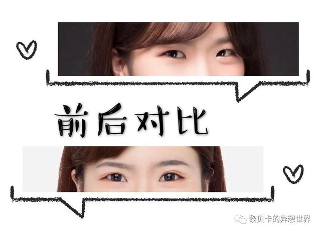 脂溢性角化激光大概费用