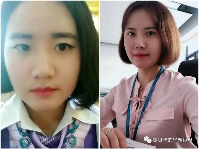 脂溢性角化激光大概费用