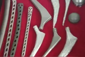 我国医用钛、生物钛合金材料的发展、分类特点、现状图片