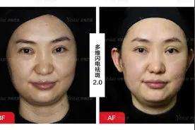 「济南艺星科普」超皮秒和皮秒到底如何选？图片